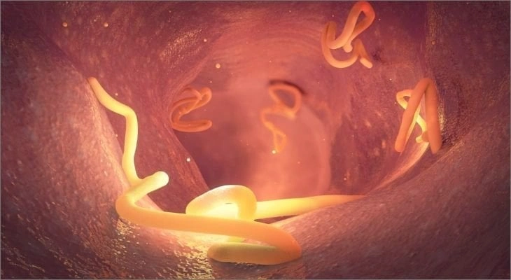 Tapeworms